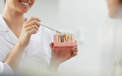 A Comprehensive Guide To Dental Implants In Tupelo, MS