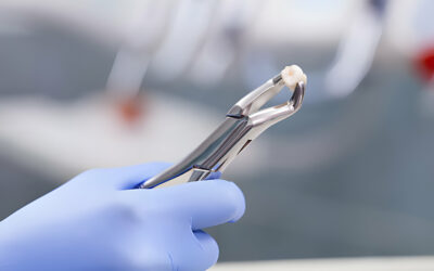 Tooth Care Extraction Tips by Main Street Family Dentistry