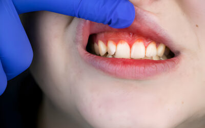 Explore 7 Key Facts About Gum Disease To Improve Your Oral Health