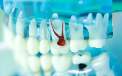 The Ultimate Guide To Tupelo Endodontics