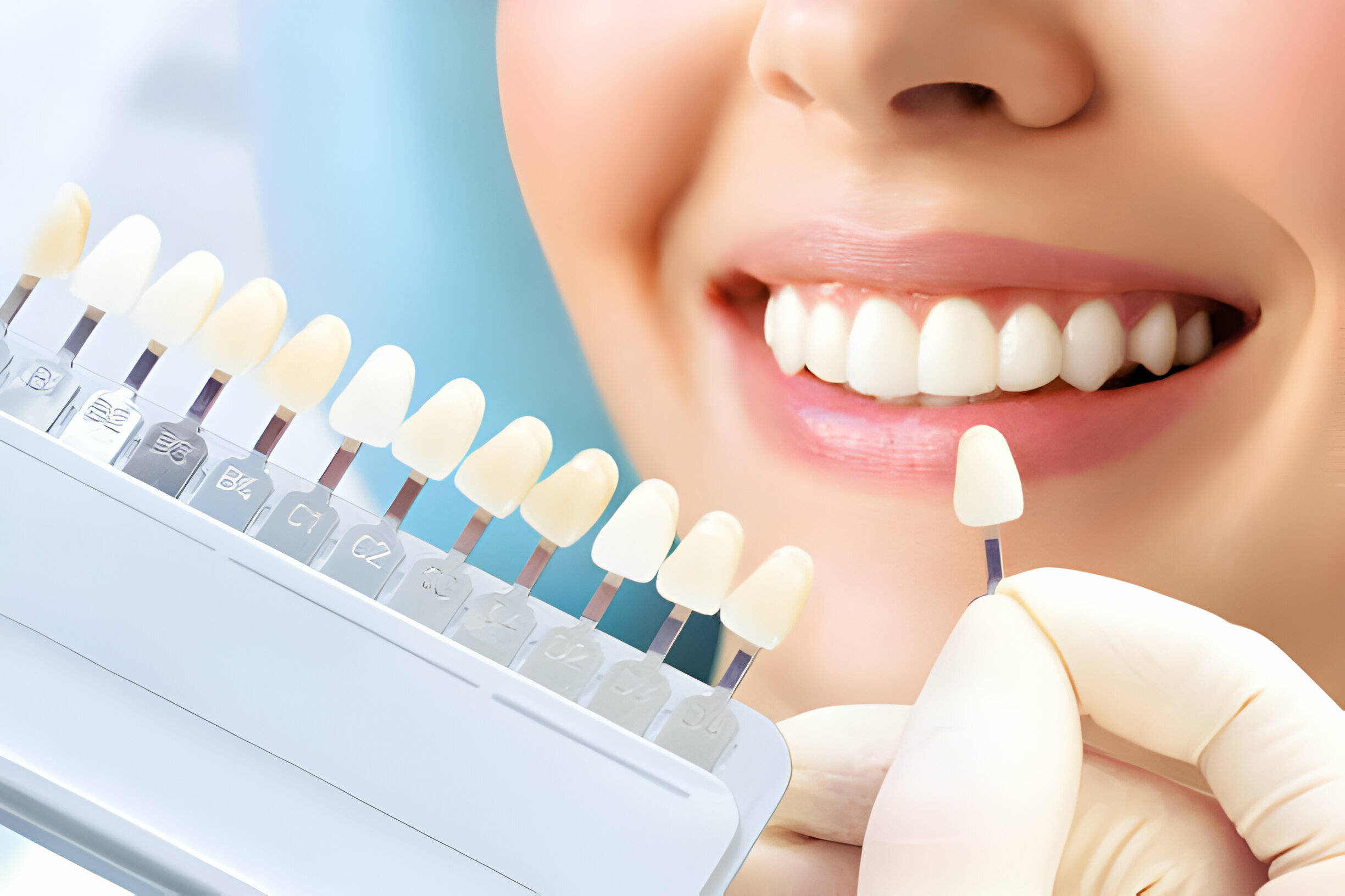 Tupelo EMAX Veneers: Find Your Perfect Smile With A Local Dentist_2