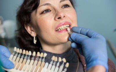 Dental Veneers: Transform Your Smile with These Easy Steps