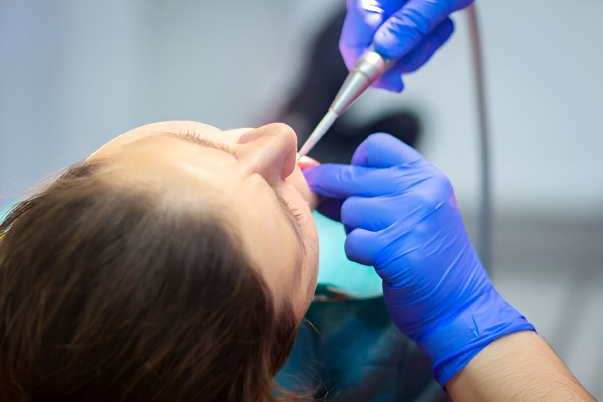 The Benefits of Sedation Dentistry: Understanding Your Options_2