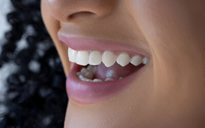 Achieve Your Perfect Smile with Emax Veneers: Expert Care at Main Street Dentistry in Tupelo, Mississippi