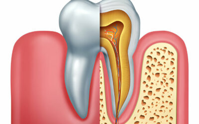 Step-by-Step Guide to Root Canal Therapy with Your Trusted Tupelo, MS Dentist at Main Street Dentistry